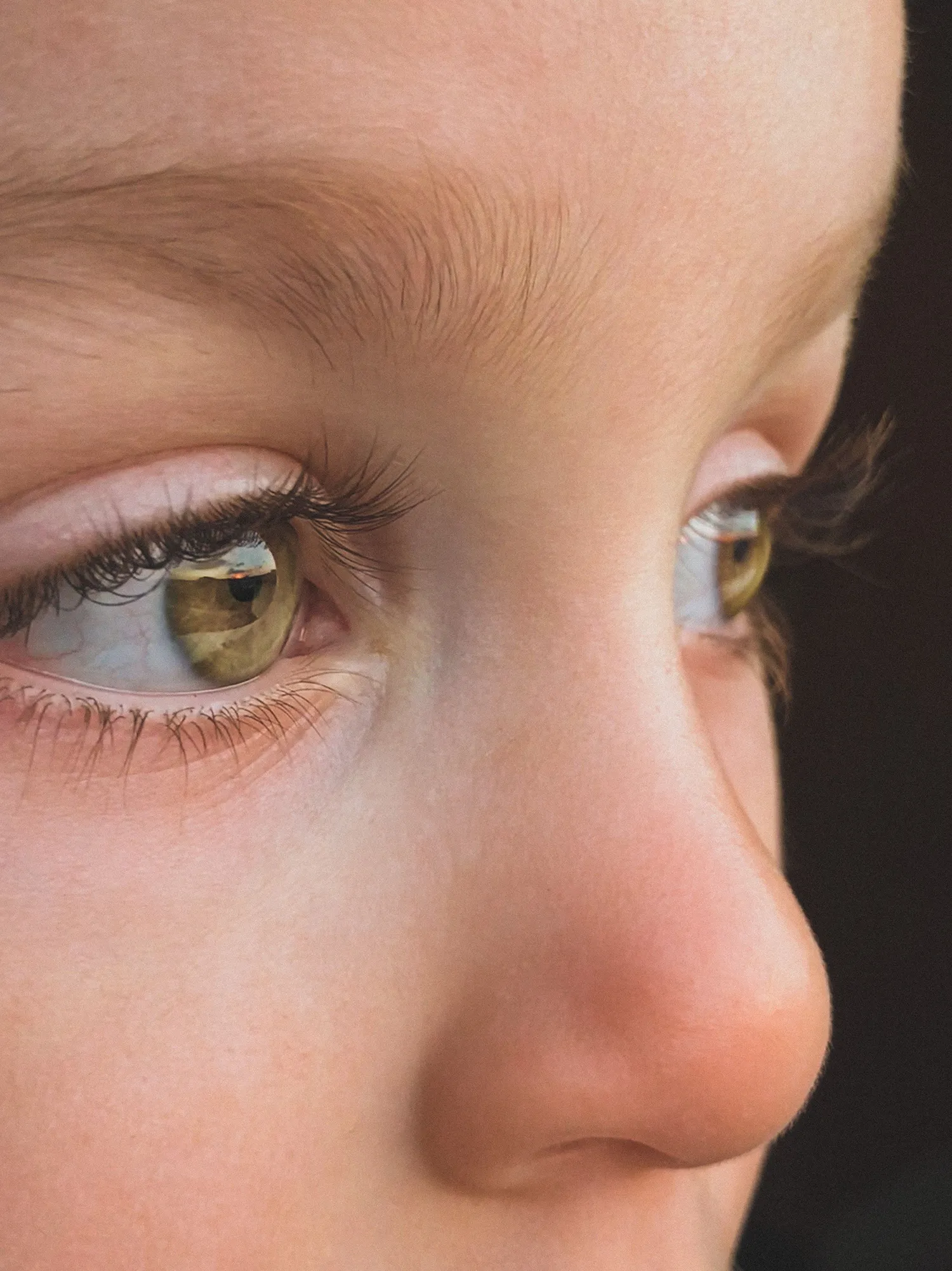 Myopia in Children - Near Sighted